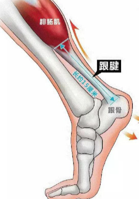 跟腱炎的治疗.jpg 跟腱炎的治疗.jpg