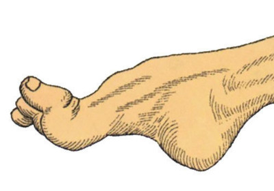 7d0c6be4ac3c4452b1ace26783a81893_th 7d0c6be4ac3c4452b1ace26783a81893_th